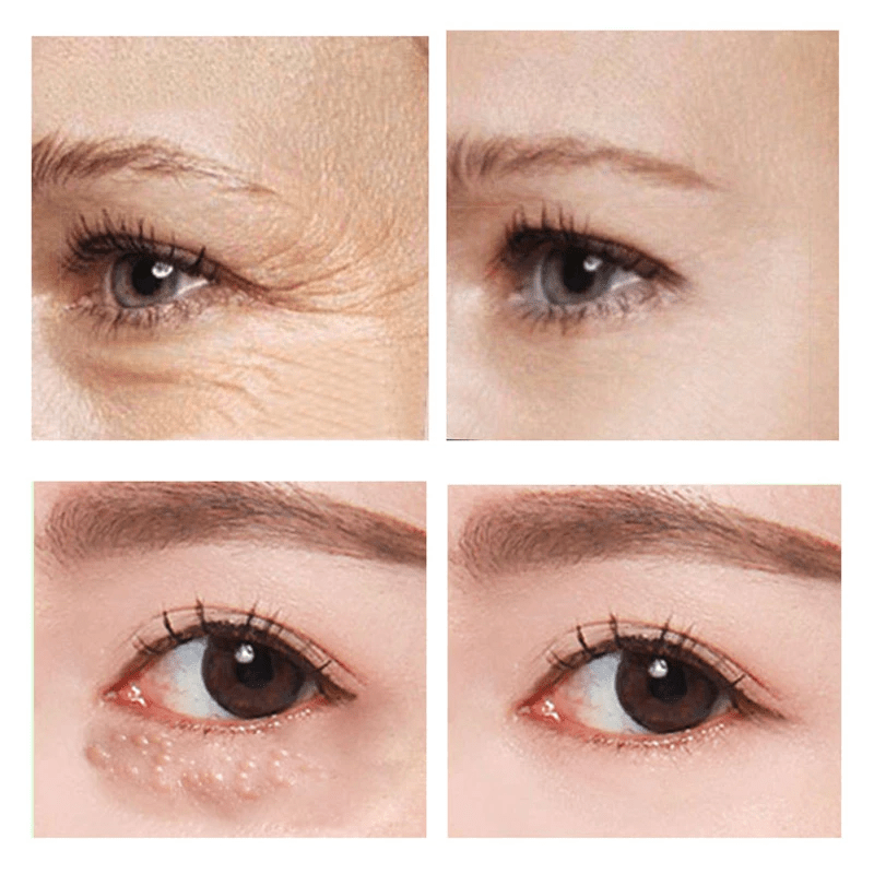 Eye Fix Snel Werkende Verstevigende Oogcrème (1+1 GRATIS)